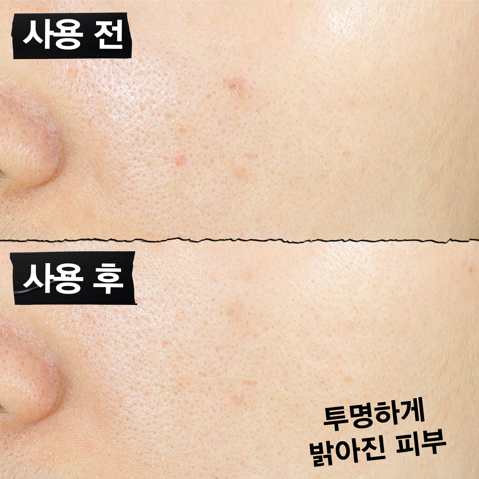 키엘 속탄력 투명 에센스 100ML 세트